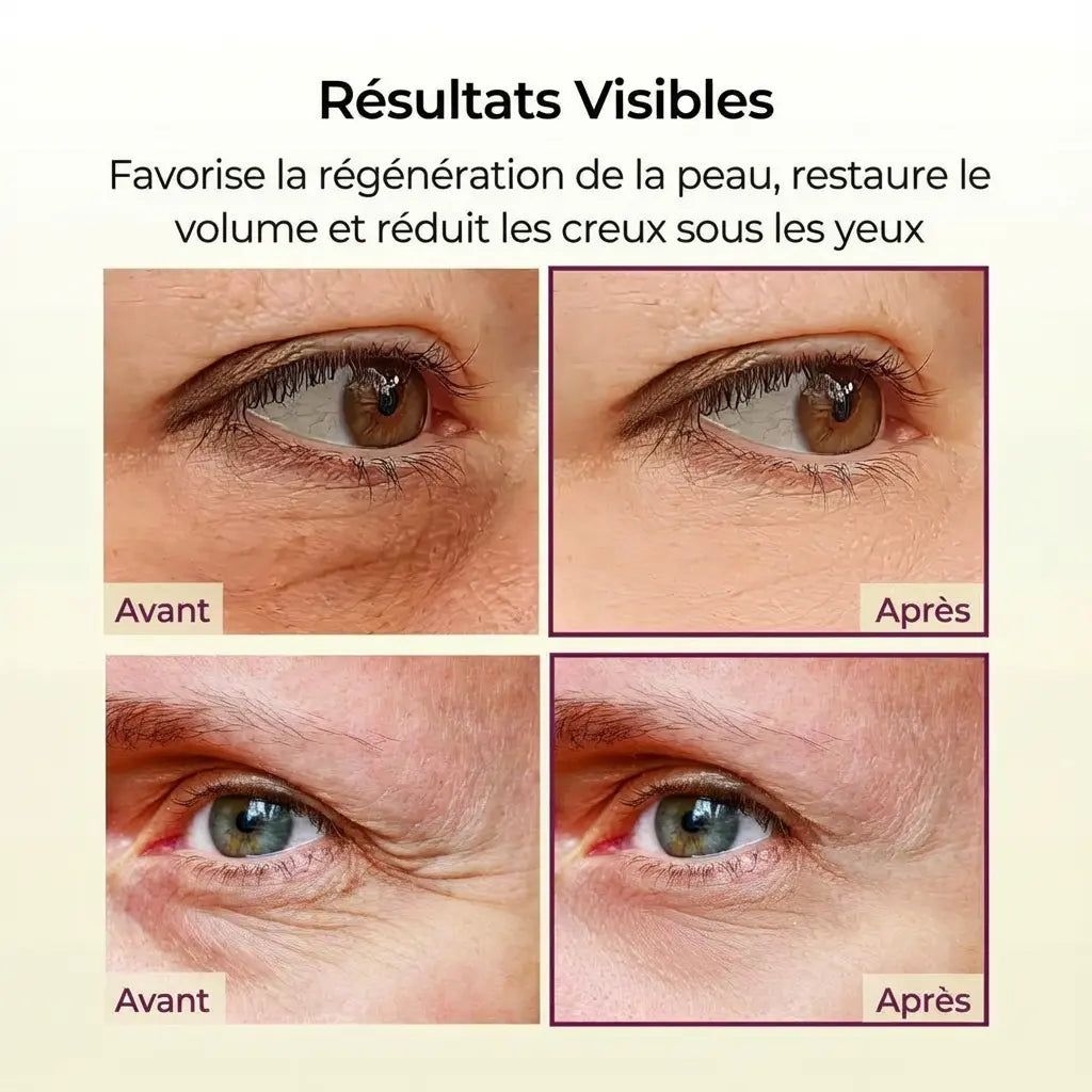 Noryelle™ Baume au calcium pour plomberie