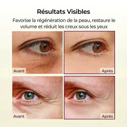 Noryelle™ Baume au calcium pour plomberie